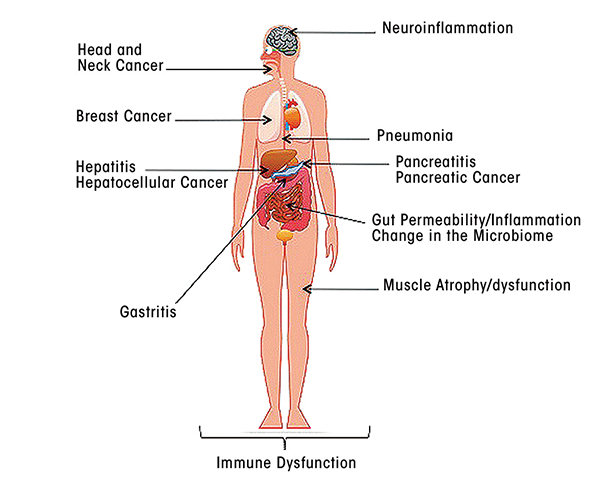 Overview of alcohol’s effects on human health that are associated with alcohol-induced dysfunction of the immune system.