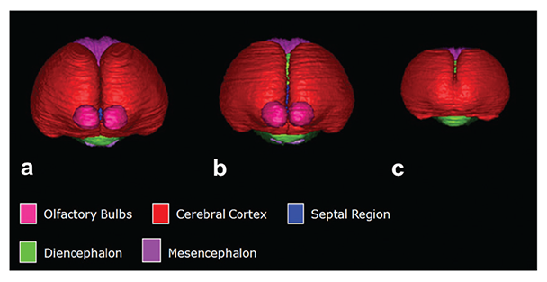 Reconstructed brains of a control fetal mouse at gestational age 17 (A) along with the brains of ethanol-exposed fetuses having mid-facial abnormality (B and C). Segmented magnetic resonance microscopy scans of control (A) and ethanol-exposed (B and C) fetuses were reconstructed
